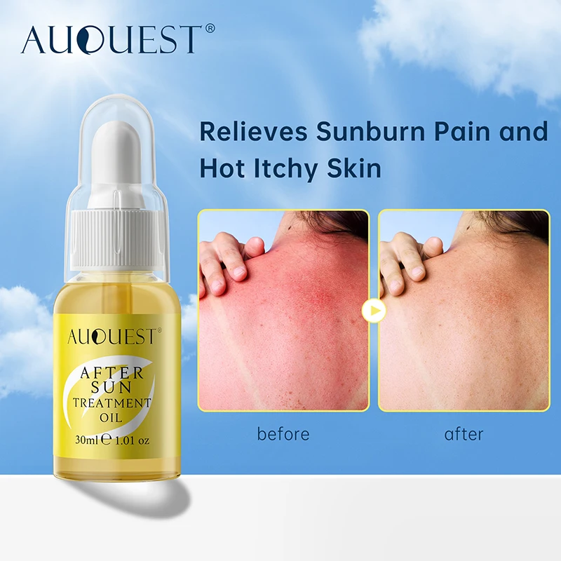 AUQUEST After Sun Treatment Oil Facial Body Sunscreen Whitening Sun Cream Sunblock Skin Protective Moisturizing Sunburn Care