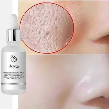Remove Large Pores Serum Lactic Acid Facial Pore Shrinking Repairing Products Pore Minimizing Firming Smooth Korean Skin Care. 1
