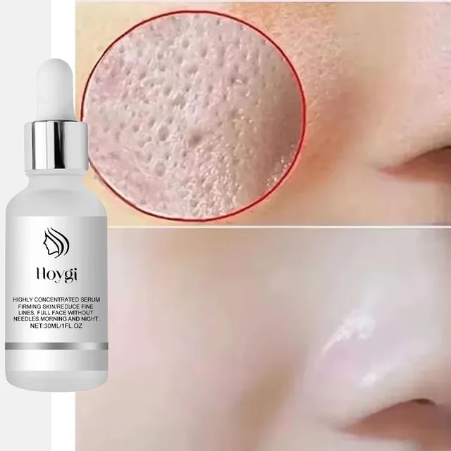 Remove Large Pores Serum Lactic Acid Facial Pore Shrinking Repairing Products Pore Minimizing Firming Smooth Korean Skin Care. 1