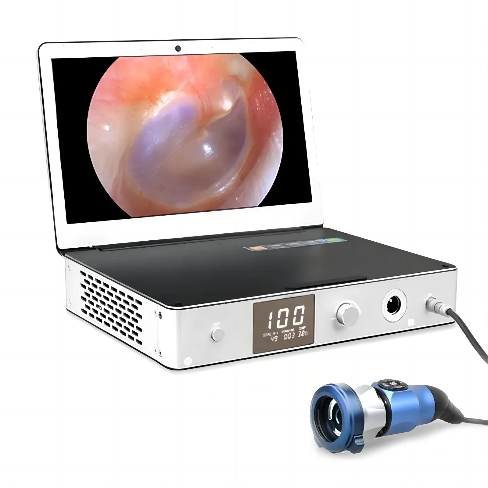 

11.6 Inch Portable Full HD Medical Endoscopy System With 30W LED Light Source/ Medical Endoscope Camera