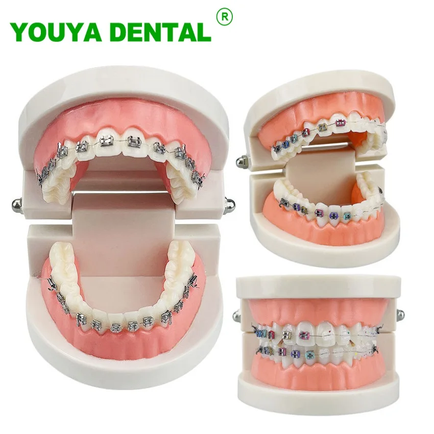 

Dental Orthodontic Treatment Model With Ortho Metal Ceramic Bracket Arch Wire Ligature Ties Dentist Tools Dentistry Products