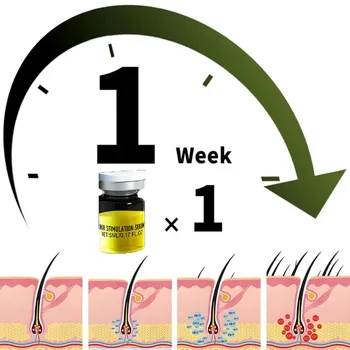 Siero per Capelli Delicato che Nutre il Cuoio Capelluto e Cura i Capelli, Trattamento Quotidiano per l'Assottigliamento dei Capelli
