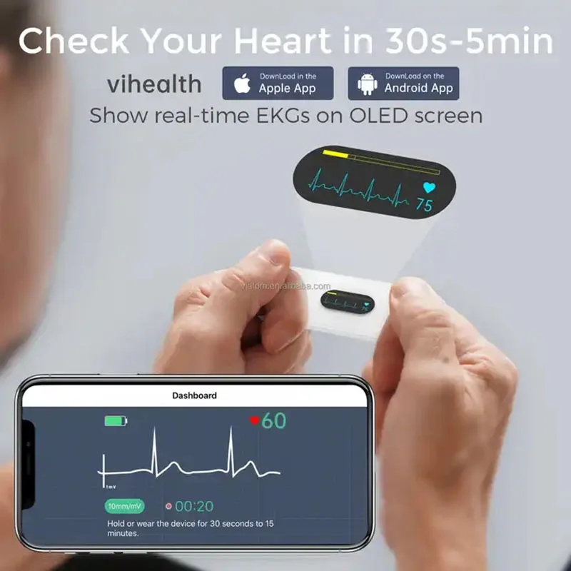 Bluetooth electrocardiogram monitor LED screen data storage dynamic electrocardiogram, handheld wireless electrocardiogram monit