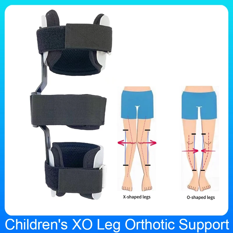 GHORTHOUD Kids O/X Leg Posture Corrector Brace Knees Valgus Straighten Bowlegged Correction
