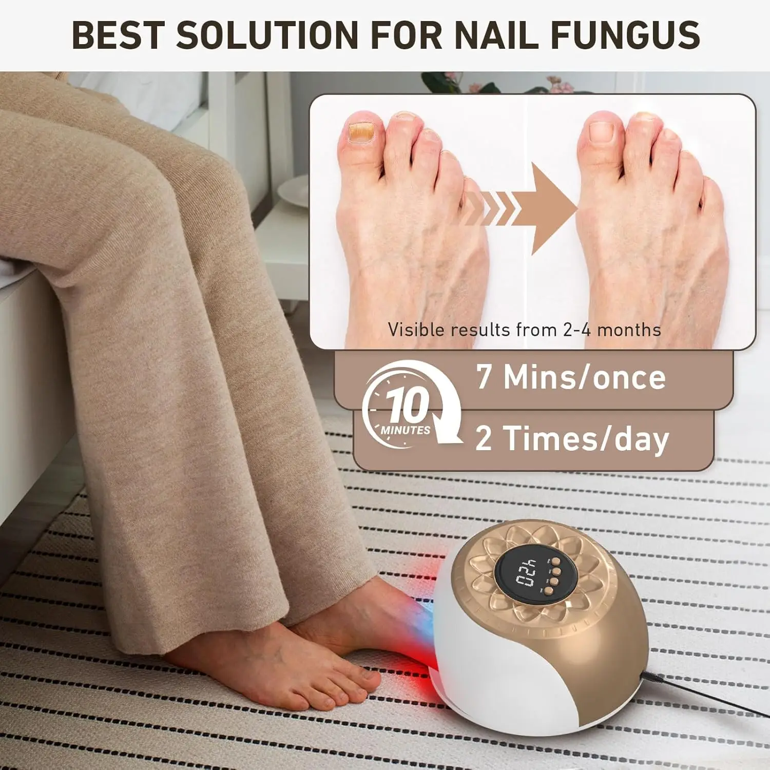 20W Nail Fungus Laser Treatment Device for Toes 470nm Blue Light+650nm Red Light Repair Toenail Fingernail Fungus TreatNail Salo