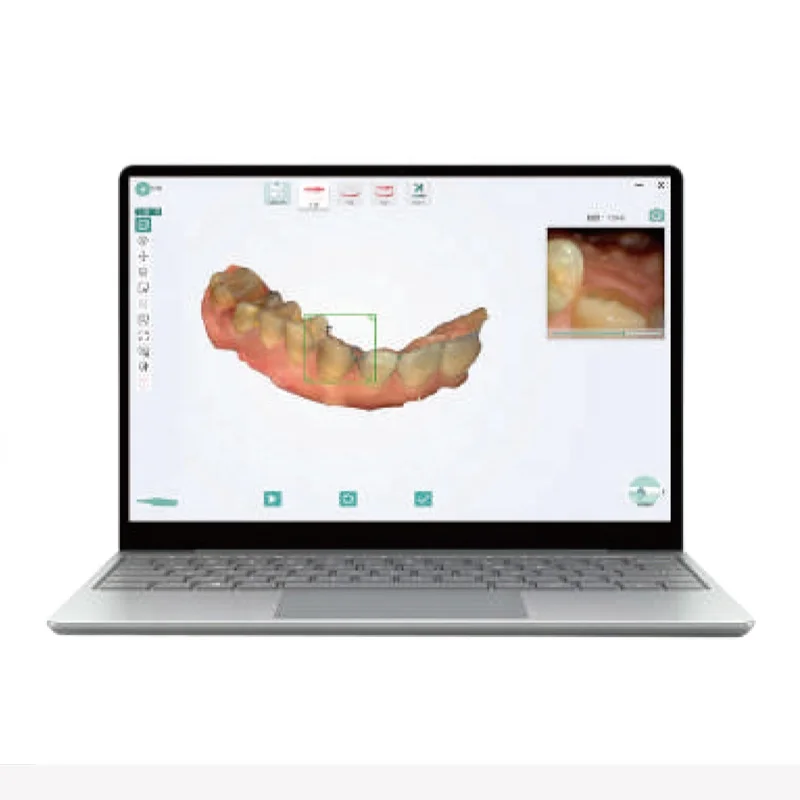 Рисунок 2 - Мощный 3D стоматологический внутриполостной