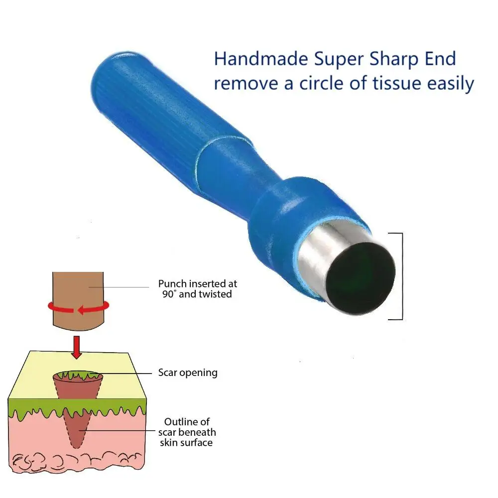 ReusableBiopsyPunchesPiercingTrephineStainlessSteelDermal