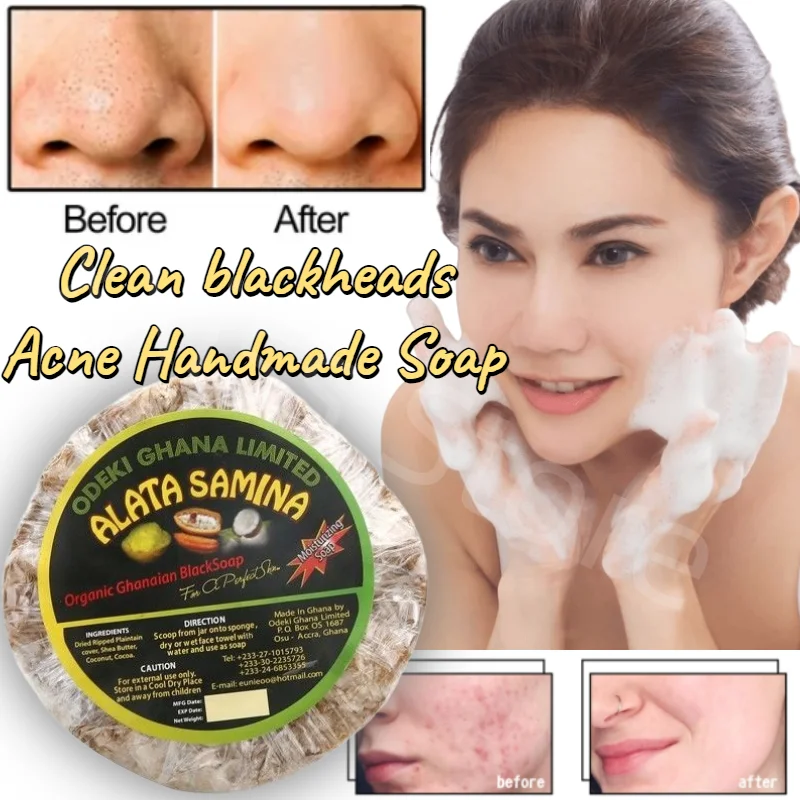 

African Shea Ugly Black Soap Black Soap Deep Cleansing To Blackhead Pores Anti-acne Bath Anti-allergic Handmade Soap