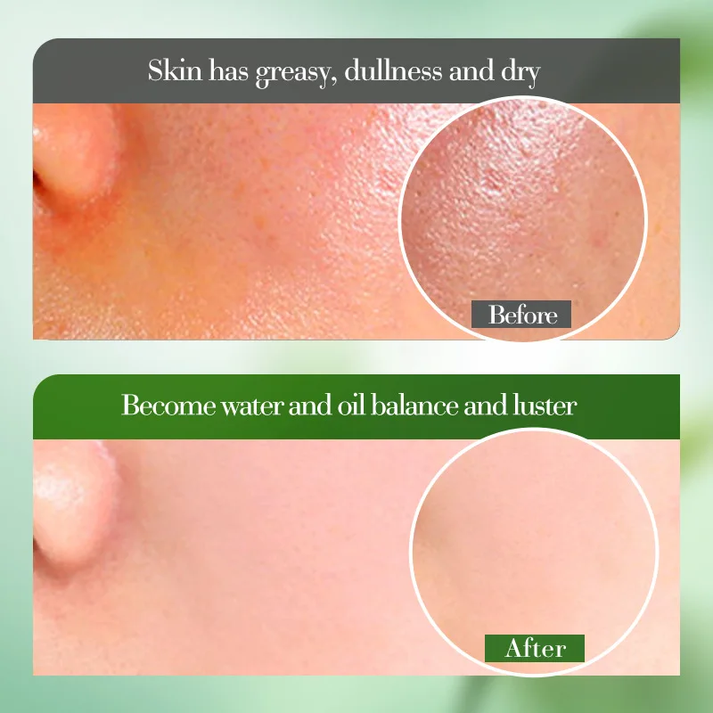 Natural Aloe Vera Moisturizing Face Cream Soothing Repairing Facial Care Lotion Brightening Hydrating Refreshing Acne Skin Care