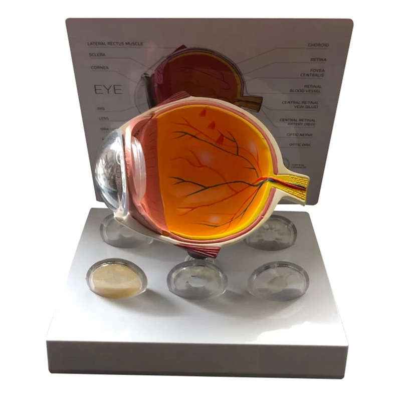 

Модель глазного яблока человеческий глаз, демонстрация глаз, катаракта глаукомы, анатомия, обучающий инструмент, глазный шар, модель поражения прочный