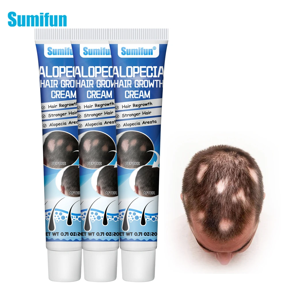 

1/2/3Pcs Sumifun Hair Growing Cream Alopecia Baldness Fast Regrowth Repair Ointment Treat Grow Hairs Root Nourish Care Plaster