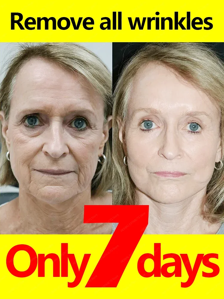 

Facial serum, improving moisturizing and nutrition, smoothing dry skin, rejuvenation brightening, beauty health