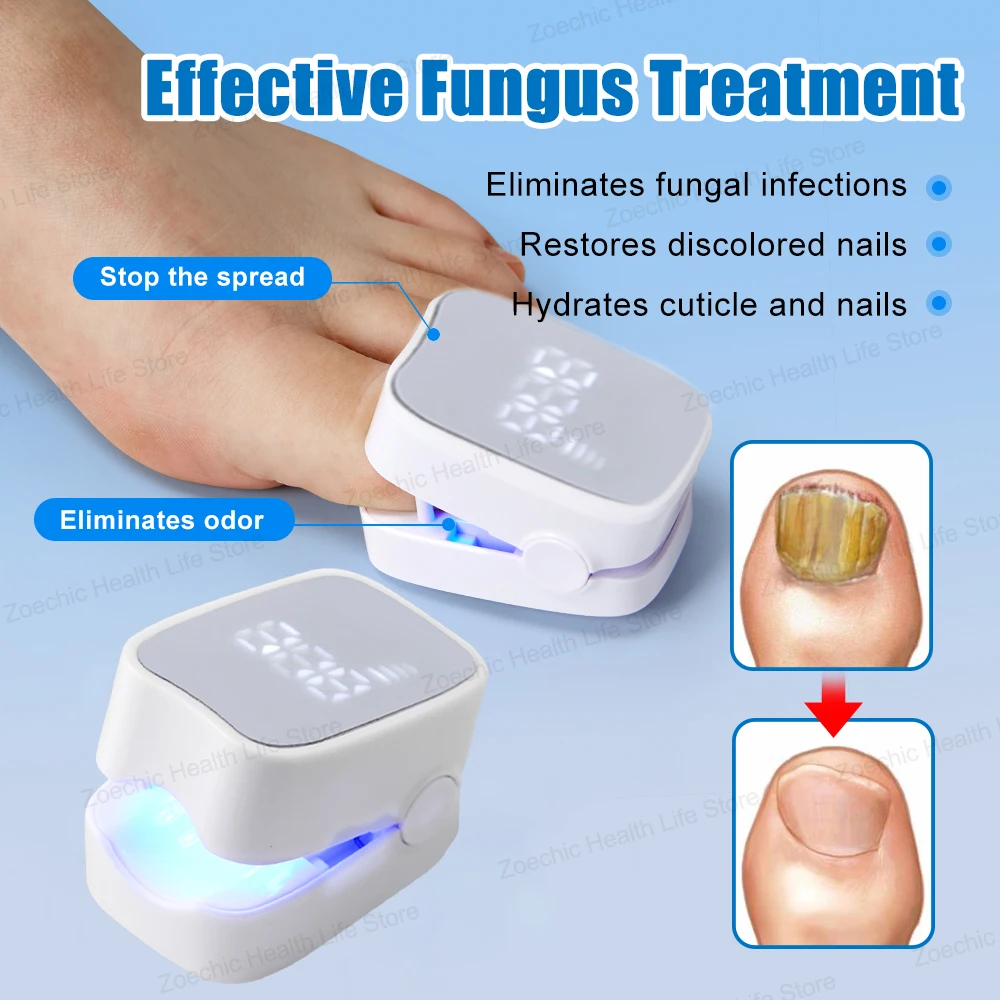 Time Display Fungal Nail Treatment Laser Device Foot Nail Repair Patch Toenail Laser Therapy Machine Ingrown Toenails Foot Care