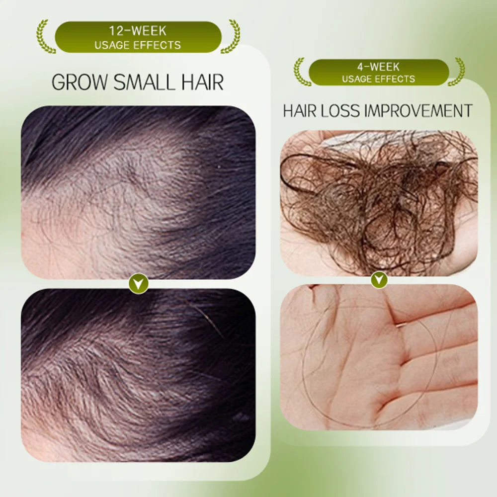 HAIRAROUSE Hair Serum Scalp Treatment, Improves Hair Volume, Strength Roots Reduce loss Herbal Serum 50ml