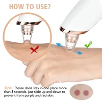 Electric Blackhead Remover Vacuum Suction USB Facial Pore Cleaner Spot Acne Pimple Black Head Extractor Face Clean Skin Care 2