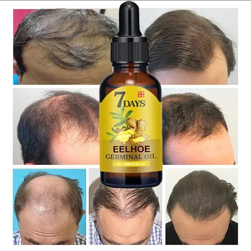 7 Day Fast Hair Growth Oil Ginger Growth Hair Treatment Anti Loss Men Women Scalp Treatment Serum Products Beauty Product hair growth serum hair care oil