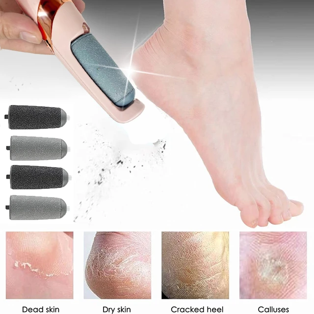 Rechargeable Electric Foot File Callus Remover Pedicure Machine Apparatus  for Heels Grinding Device Foot Corns Remove Roller - AliExpress