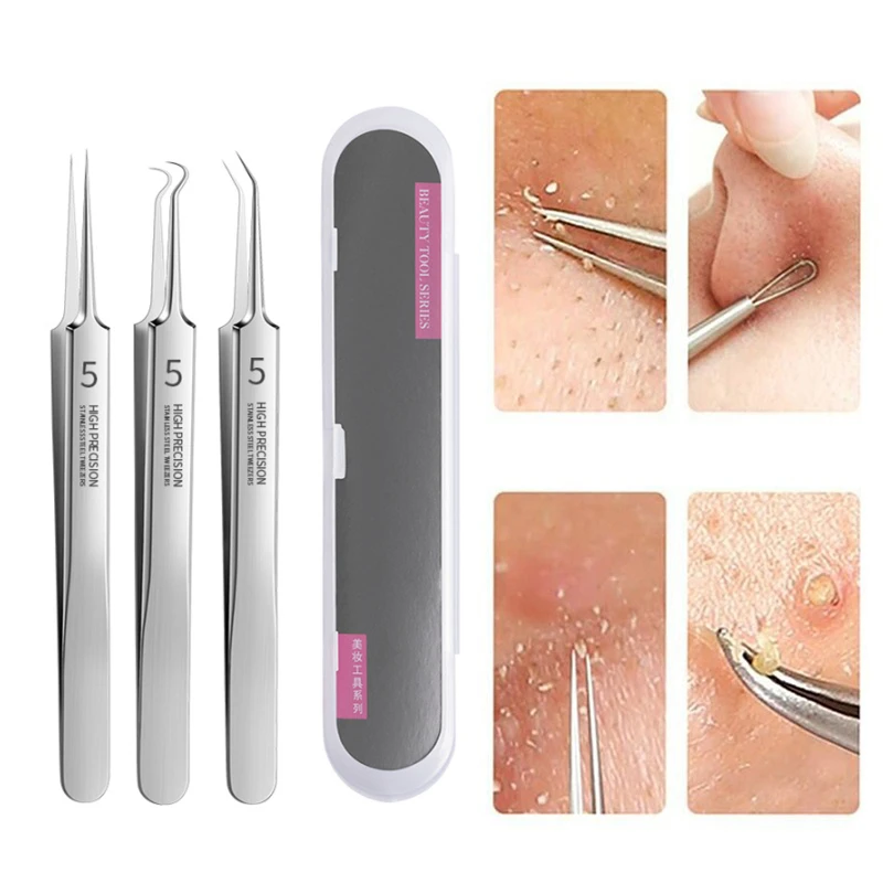 German Ultrafine NO.5 Cell Pimples Blackhead Clip Blackhead Remove