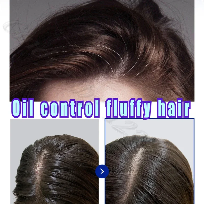 440ML large capacity selenium disulfide antipruritic shampoo oil fluffy to improve the scalp environment 3