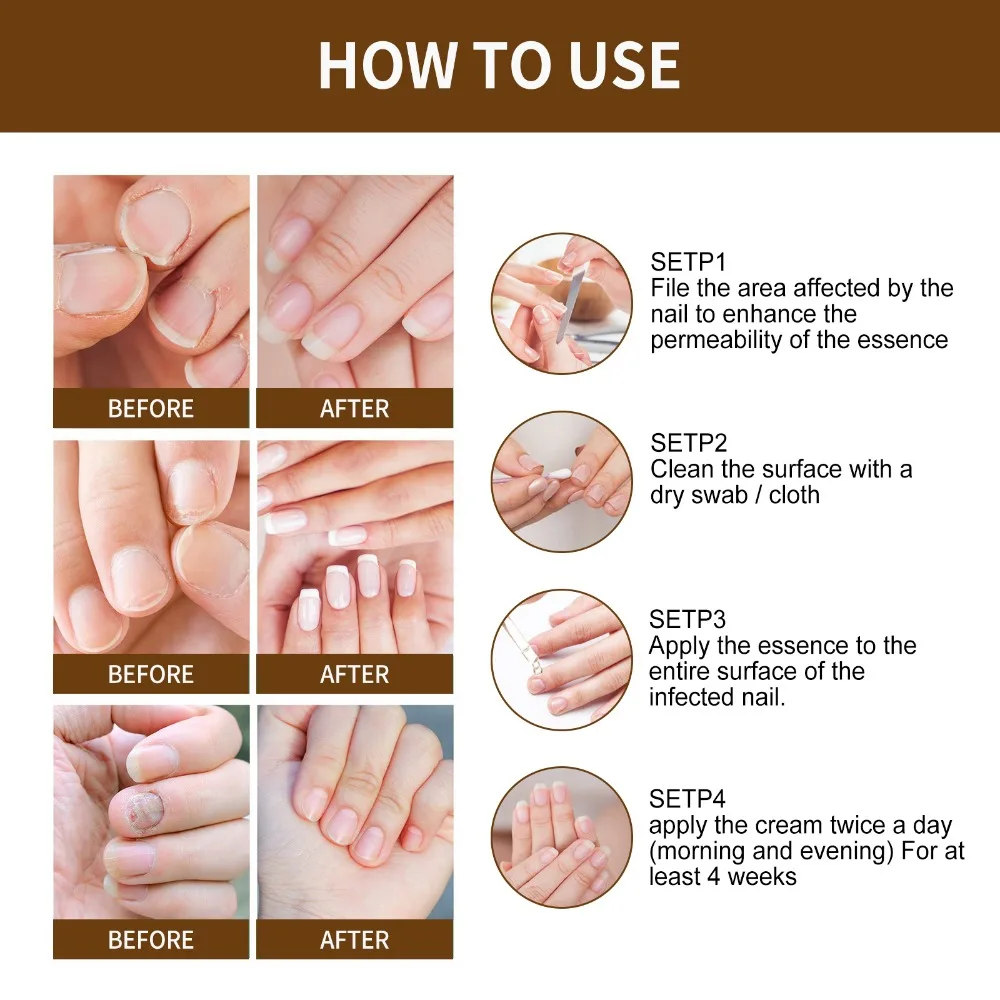 Рисунок 4 - Эссенция для восстановления ногтей