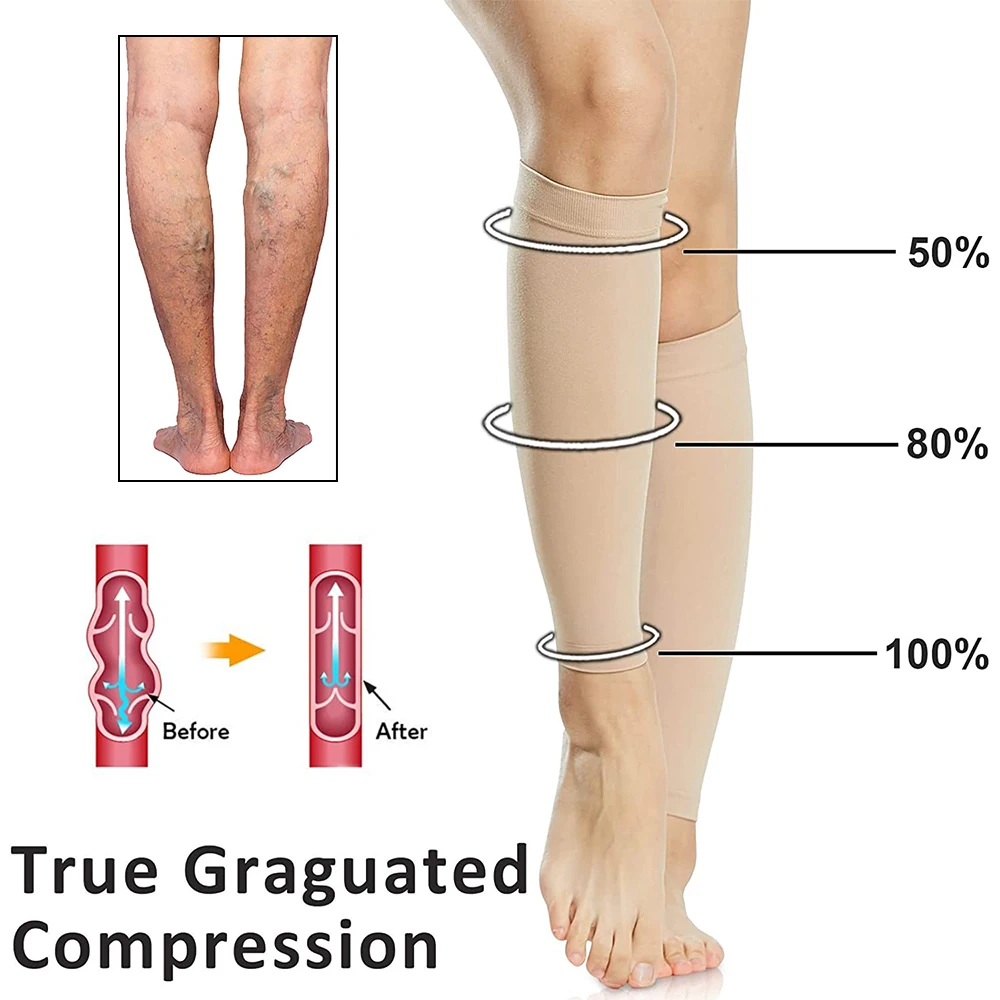 Compression Leg Sleeves Varicose Veins