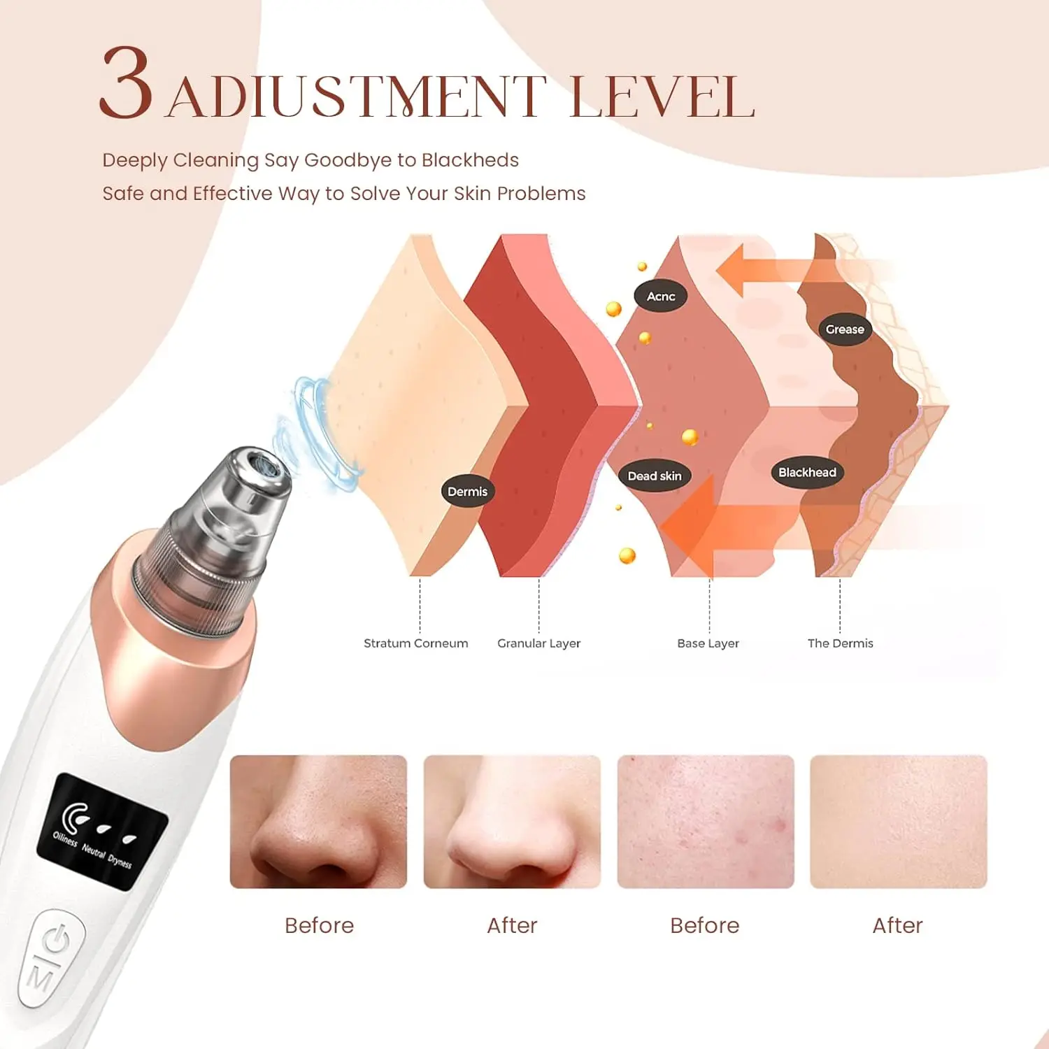 Newest Technology Blackhead Remover Vacuum Pore Cleaner for Face&Nose Blackhead Removal Kit Electric Acne Facial Extractor Tool 3