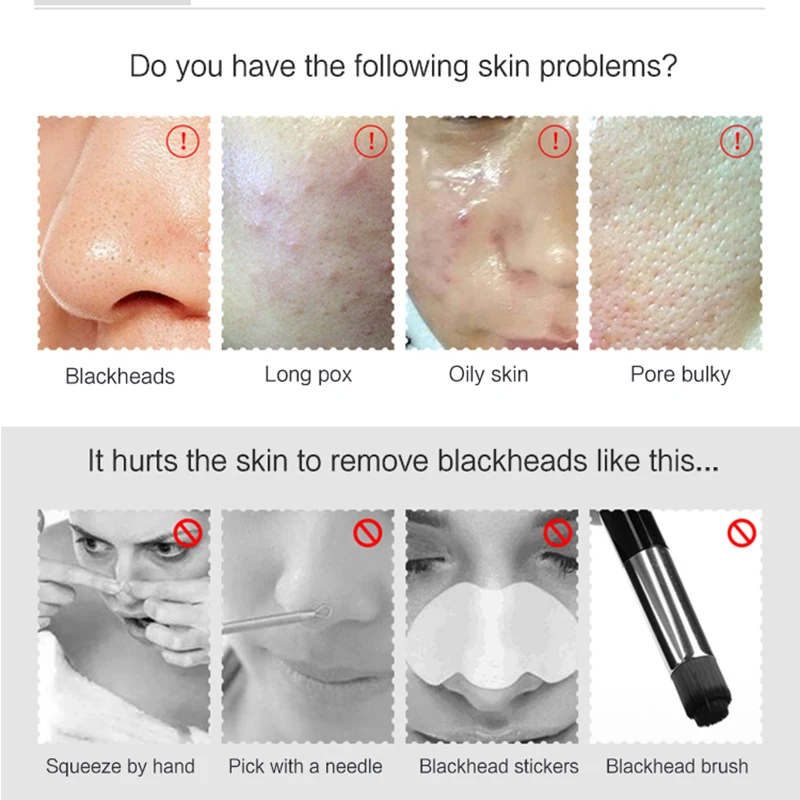 Electric Blackhead Remover Vacuum Cleaner Black Spots Removal Facial Deep Cleansing Pore Cleaner Machine Face Skin Care Tools us