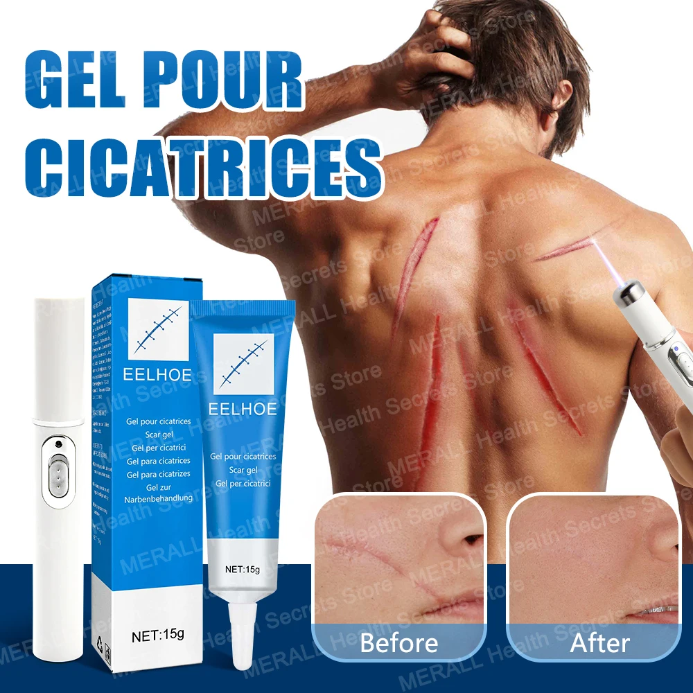 Scar Repair Gel Pen Treatment Improve Keloid Stretch Mark Whitening Body Care
