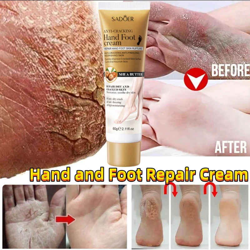 

Anti Crack Hand Foot Cream Anti-Drying Heel Cracked Repair Feet Mask Removal Dead Skin Moisturizing Whitening Feet Care Products