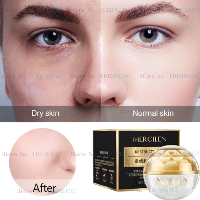 Kollagén Töltelék Krém 70 G Fagyasztás Faad Finom Ráncok Hidratáló Niacinamide Esszencia Megvilágítja A Vonalakat - Image 3
