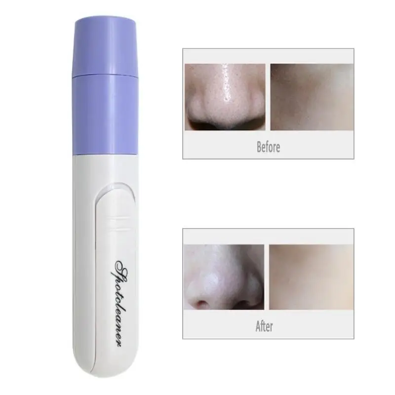 Hot Portable Facial Pore Clean Cleaner Blackhead Spot Zit Acne Remover Facial Skin Cleansing Care Tool Face Beauty Machine