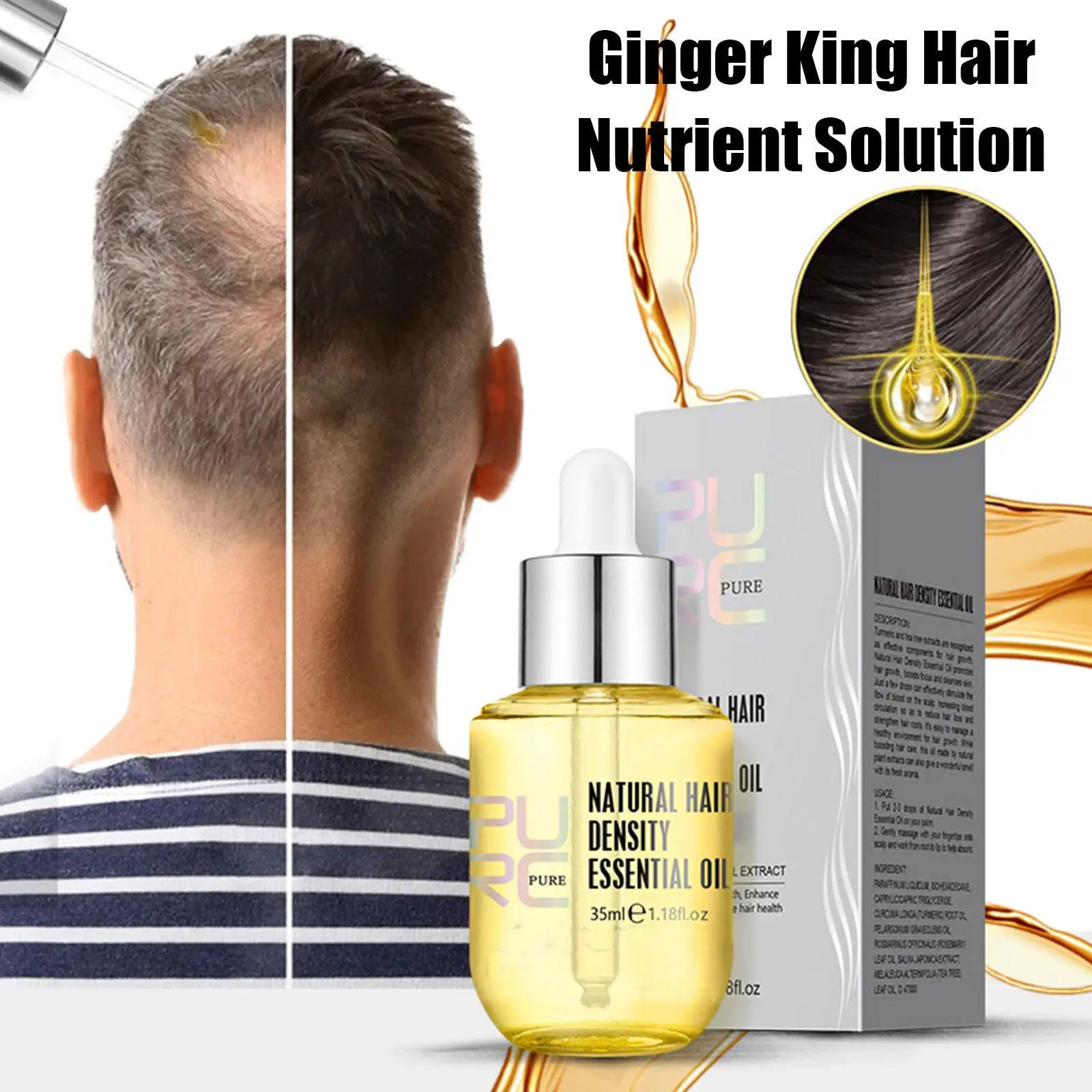 PURC 35ml Ginger Essence Oil Men Women Hair Loss Thinning Treatment Liquid Fast Regrowth Hair Density Essential Oil hair growth serum hair growth spray hair growth cream