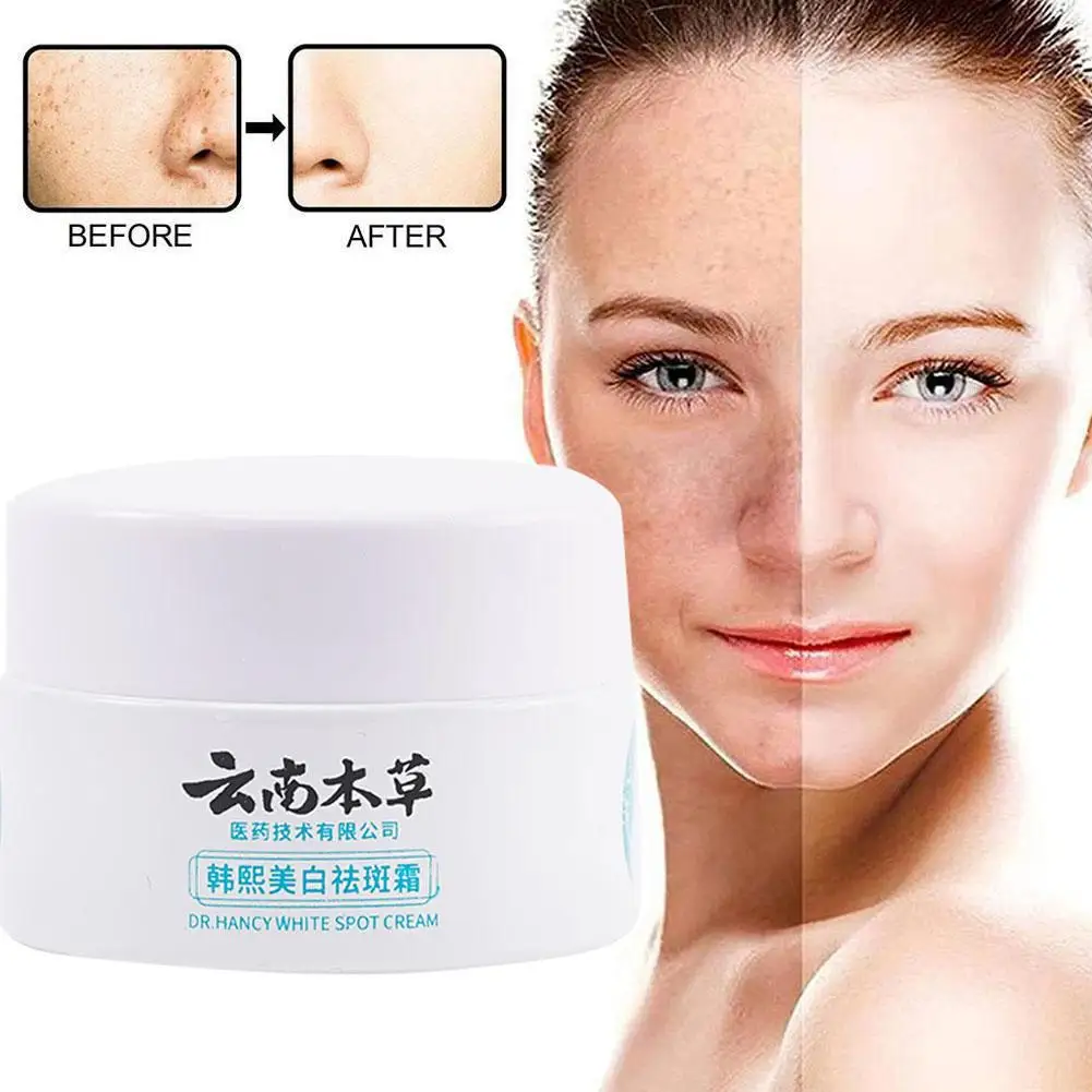 

20g Spot Yunnan Face Cream Whitening Cream Remove Acne Skin Pigment Spots Moisturizing Brightening Care Cream Spots A8L5