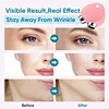 EMS Face Lifting Device Facial Microcurrent Roller Massage Sonic Vibration Skin Tightening Rejuvenation Anti Wrinkle Beauty Care 6