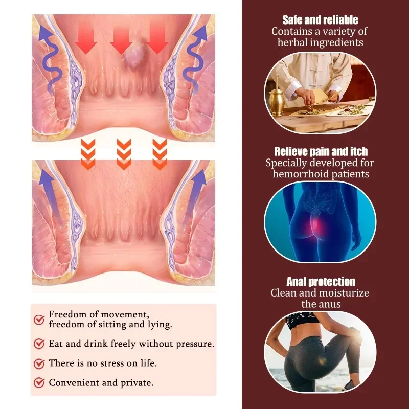 1Pcs Herbal Hemorrhoid Ointment Treat Butt Anal Fissure Pain Swell Repair Cream Internal External Hemorrhoids Eliminates Care