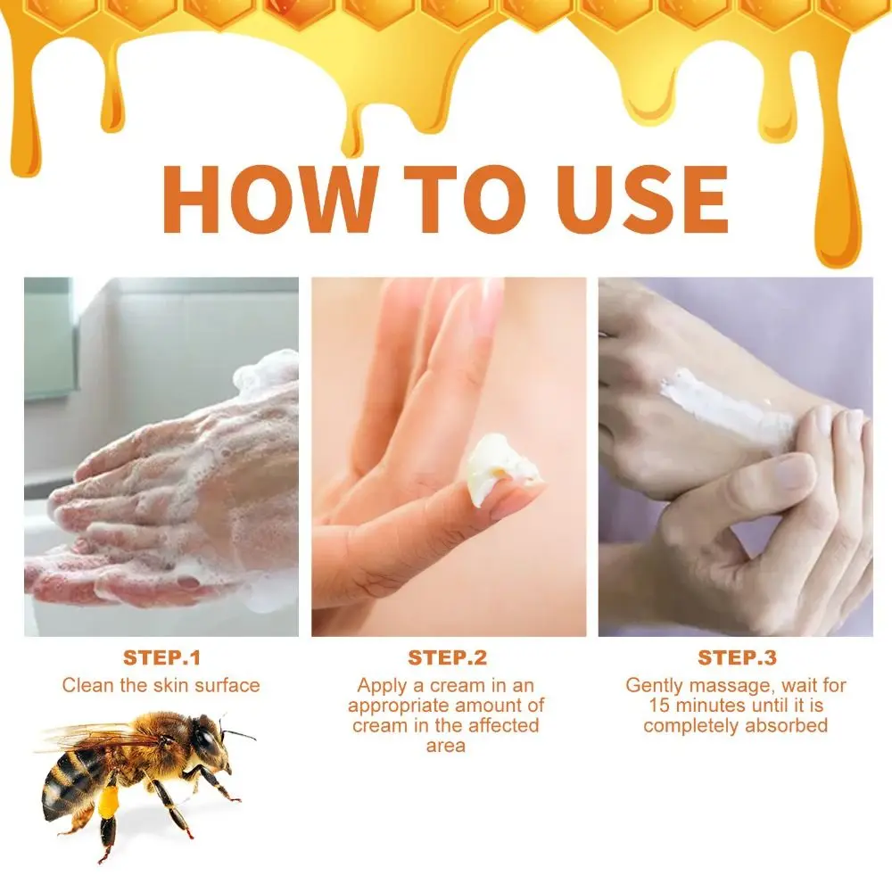 Repair Hands and Feet Skin Moss Bee Venom Psoriasis Cream Smooth Moisturizing Bee Venom Cowhide Moss Cream Red Itchy Skin Care