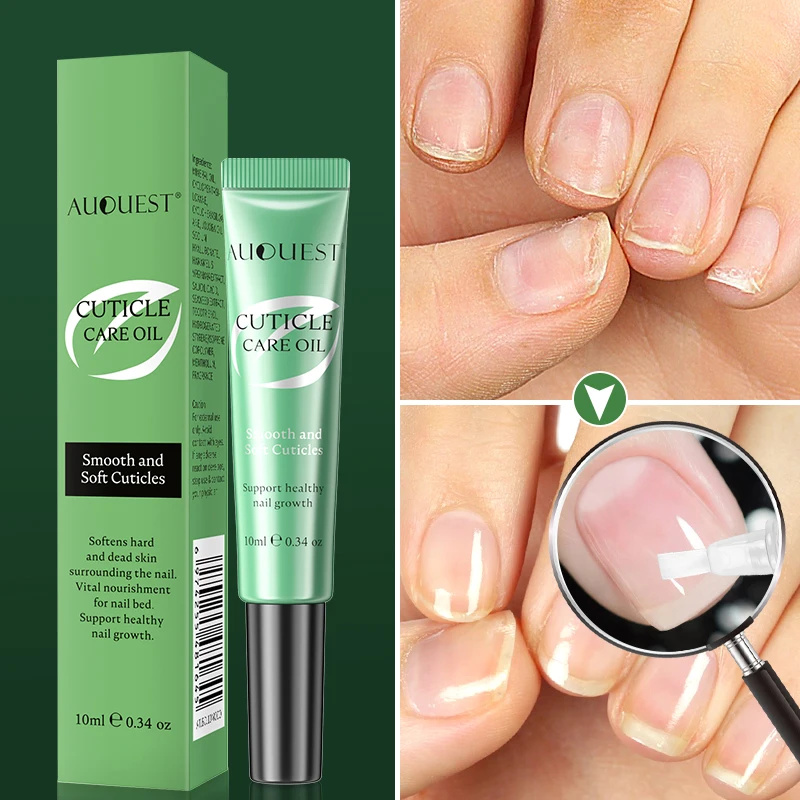 Auquest Cuticle Oil Pen Nail Nourishment Fungus Treatment Gel Nourish Nail Polish Beauty Health