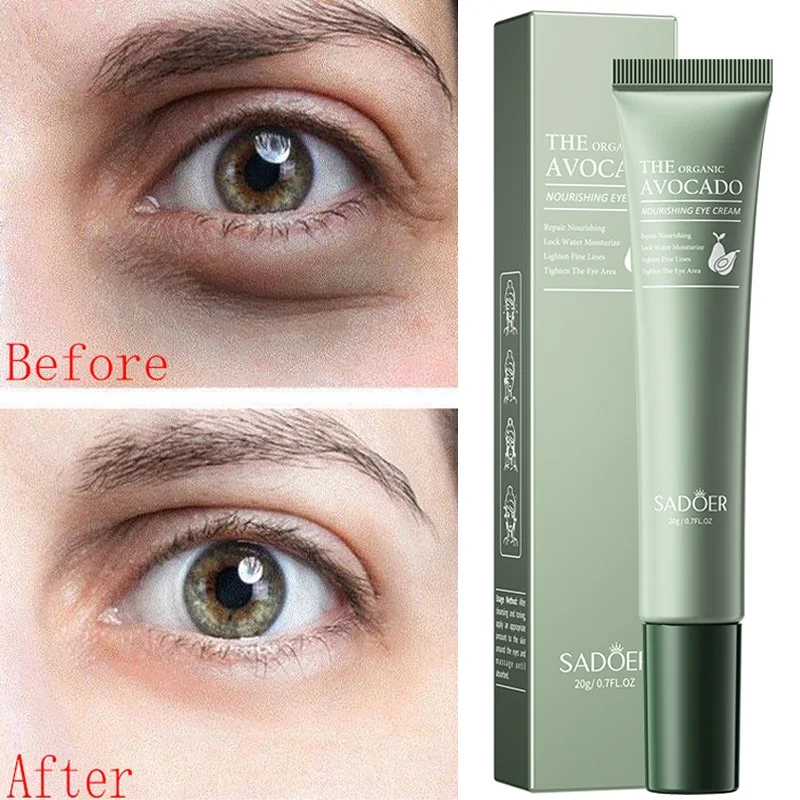 

Remove Dark Circles Eye Cream Anti-Wrinkle Fade Fine Lines Moisturizing Relieving Dry Skin Bags Puffiness Care 20g