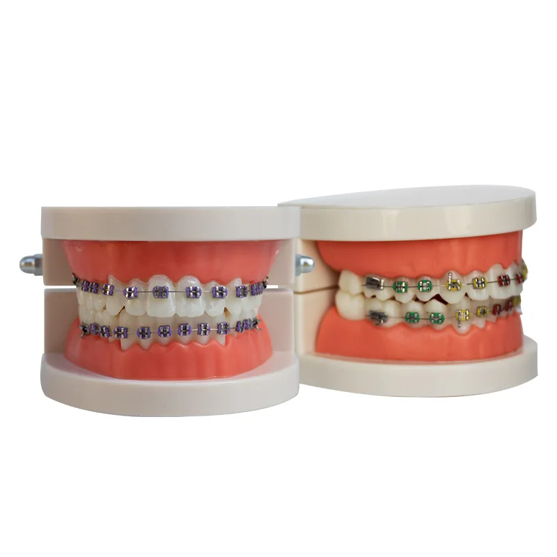 5-teiliges Zahnmodell für Kieferorthopädie mit Brackets, Bogendraht, Bukkalröhrchen und Ligaturen - Lehrmittel für Zahnärzte und Labore