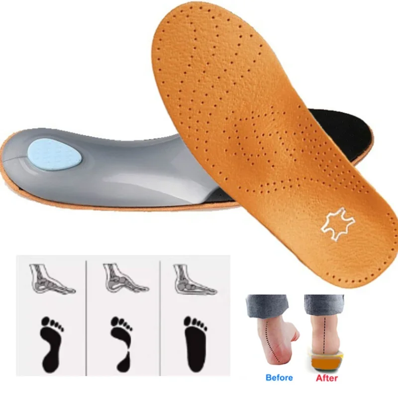 cowhide Shoes Insole Leather Orthotic Insoles Flat Feet High Arch Support Orthopedic Shoes Sole Fit In O/X Leg Corrected Insert orthopedic insoles shoe insoles
