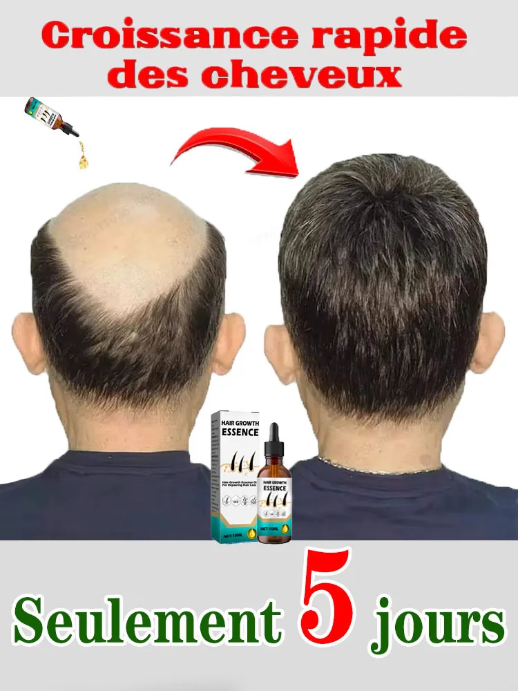 Green bottle. Essential for air growth. Say goodbye to the children. The secret of thick hair growth essence