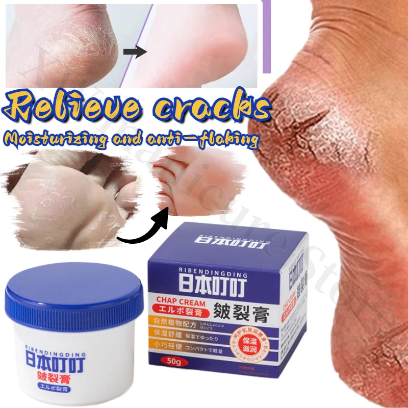 Cracking Cream 50g Hand and Foot Care Can Be Used To Moisturize and Moisturize Children's Antifreeze Cream Skin Repair Cream children s wooden vegetables and fruits cut and seen in real objects and puzzle toys are used as early childhood teaching aids