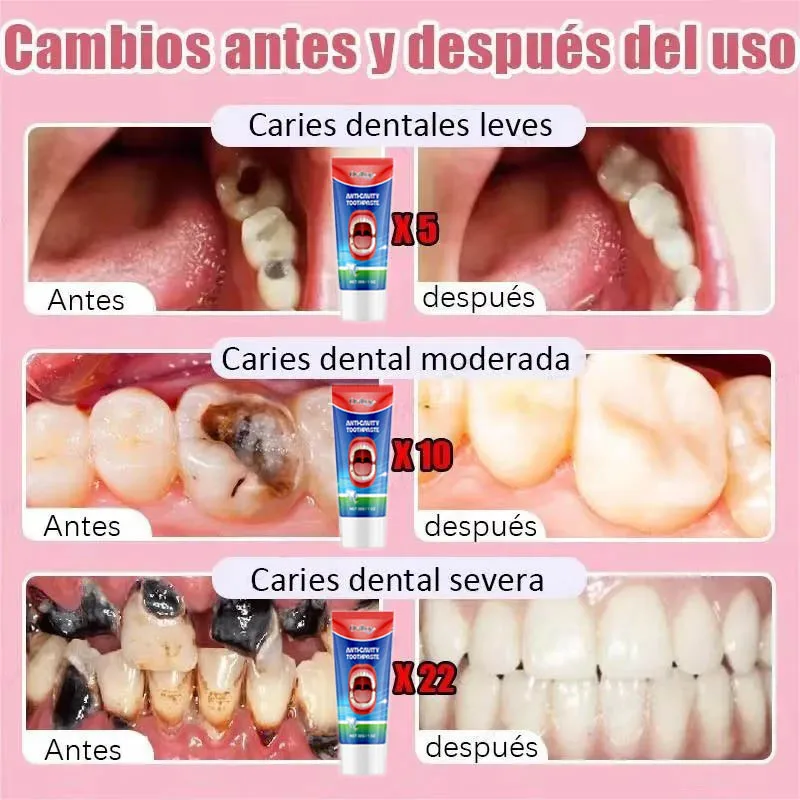 Repair Tooth Decay teeth health product