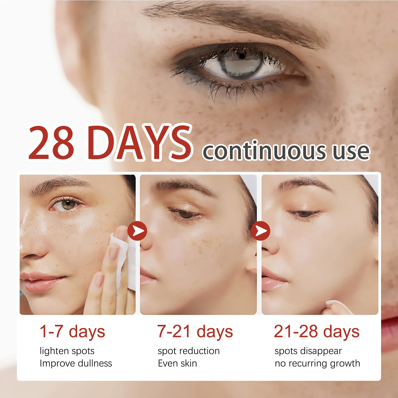 Effektive Whitening Freckle Cream Fade Dark Spot Melasma Melanin Anti-Aging Brighten Moisturizing Repair Face_voghion.com