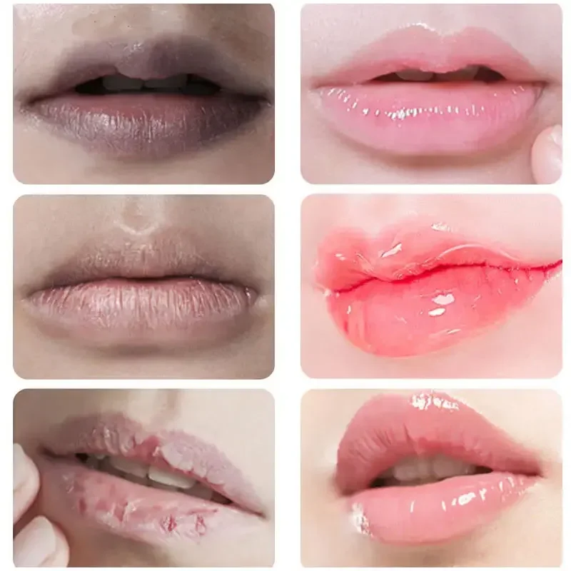 Remove Dark Lip Balm Lightening Melanin Mask Gloss Oil Exfoliating Clean Deep Moisturizing Makeup Korean Beauty Care Products