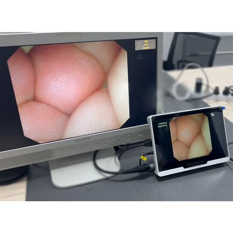 Рисунок 3 - Гибкий видео уретероскоп для цифрового