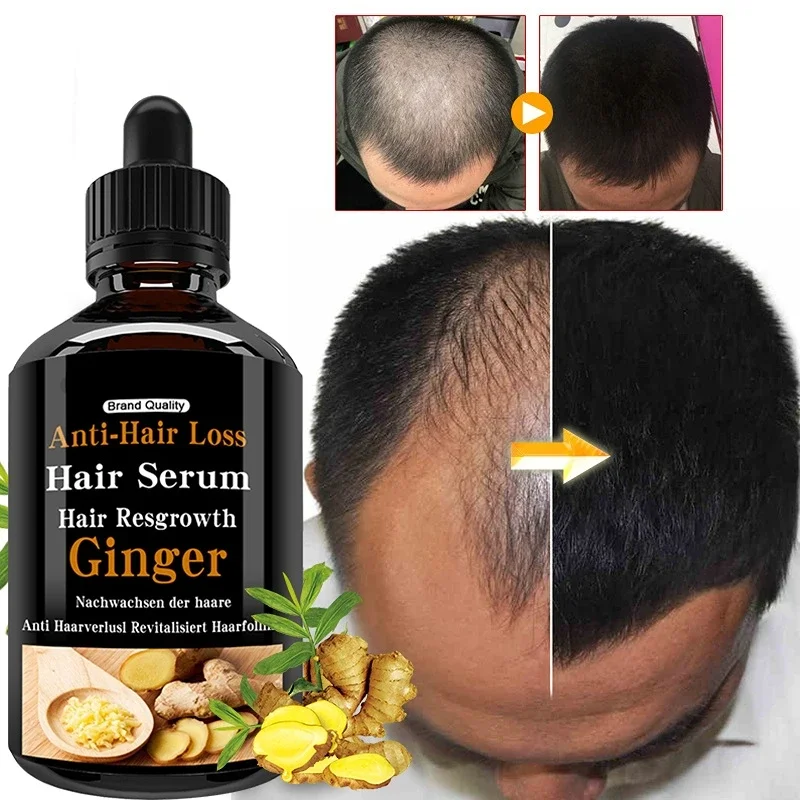 

Hair Care Tool Hair Growth Oil Essential Oils Essence Original Hair Loss Solution Health and Beauty Dense 2022 New