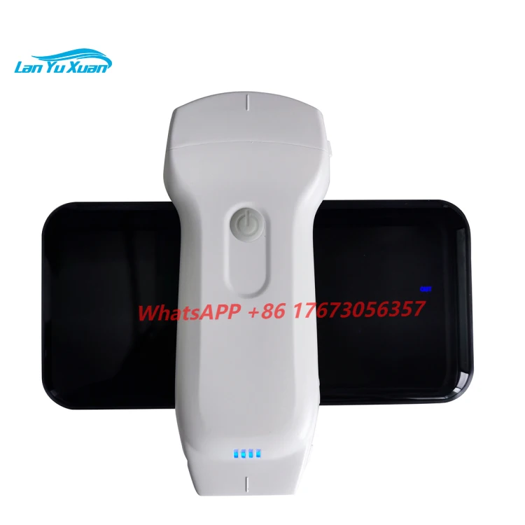 

Hot Selling Wireless Ultrasound Scanner Highest Cost-effective Double Probes Wireless Color Doppler Ultrasound Scanner