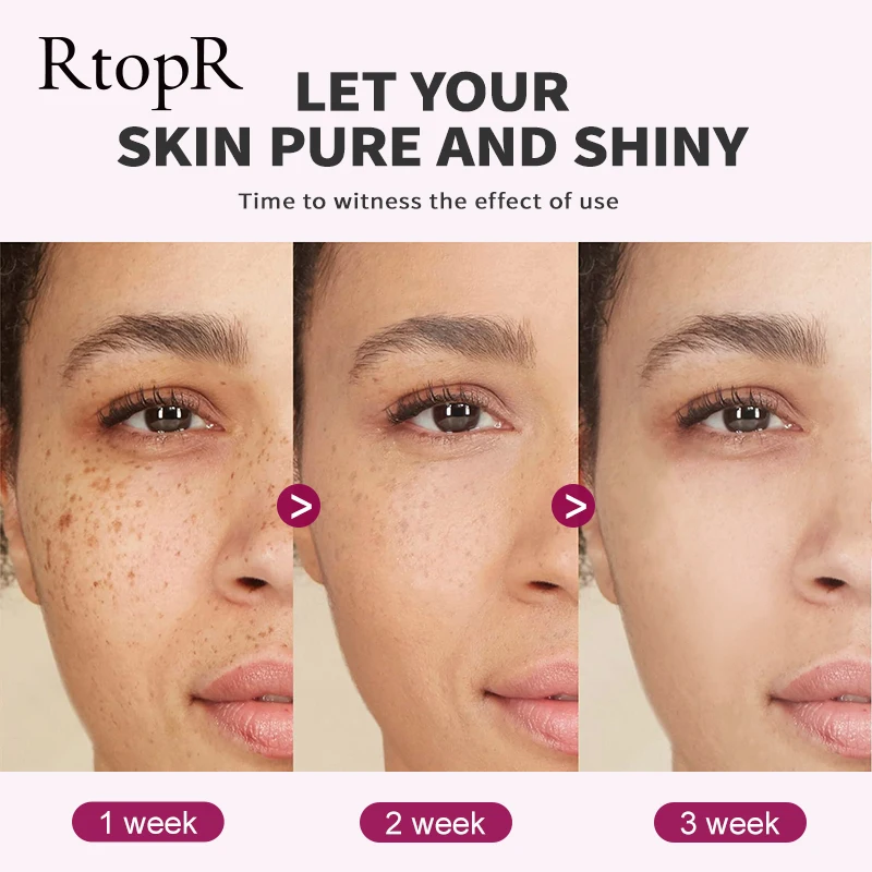Vitamin C Snail Essence Anti-aging Anti-wrinkle Shrink Pores Whitening  Moisturizing Essence Oil Control Face Essence Skin Care 2