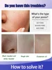 Removing Large Pores Pore Shrinking Serum Face Tightening Repairing Facial Pore Minimizing Moisturizing Skin Care Product 2